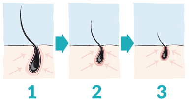 life-cycle-of-a-hair